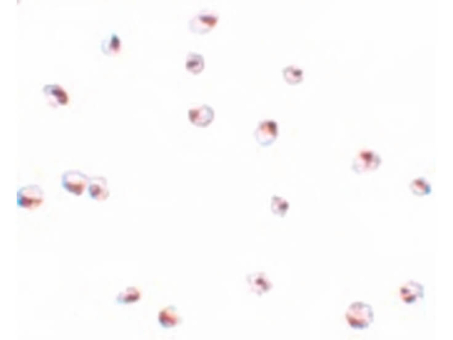 SAE2 Antibody in Immunocytochemistry (ICC/IF)