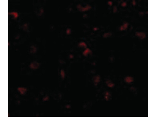 SAPAP1 Antibody in Immunocytochemistry (ICC/IF)