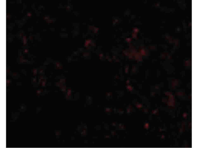 SCARB1 Antibody in Immunocytochemistry (ICC/IF)