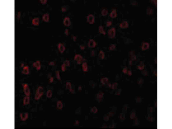 SCF Antibody in Immunocytochemistry (ICC/IF)