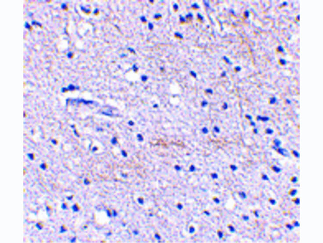 SCRAPPER Antibody in Immunohistochemistry (Paraffin) (IHC (P))