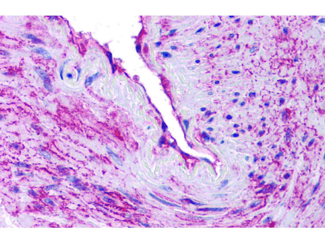 SCUBE3 Antibody in Immunohistochemistry (Paraffin) (IHC (P))