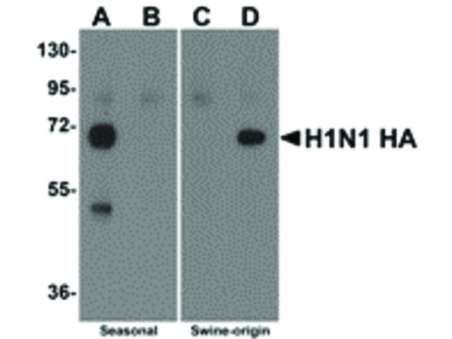Seasonal H1N1 Hemagglutinin Antibody in Western Blot (WB)