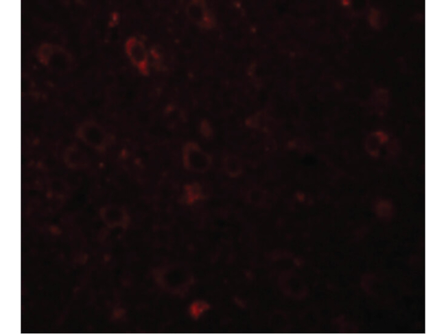 SESTD1 Antibody in Immunocytochemistry (ICC/IF)