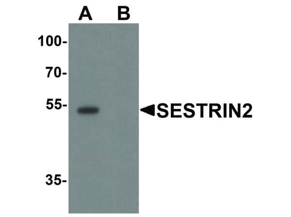 SESTRIN2 Antibody in Western Blot (WB)