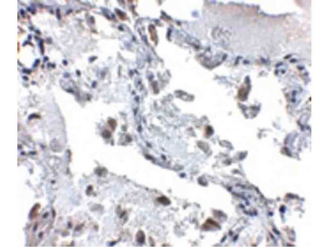 SH3BP4 Antibody in Immunohistochemistry (Paraffin) (IHC (P))