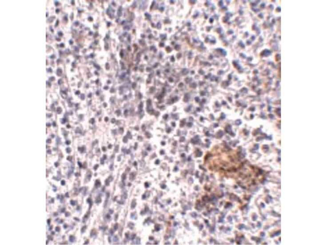 SHOC2 Antibody in Immunohistochemistry (Paraffin) (IHC (P))