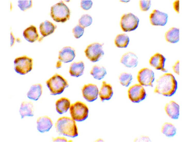 SIGIRR Antibody in Immunocytochemistry (ICC/IF)