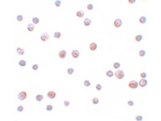 SIP1 Antibody in Immunocytochemistry (ICC/IF)