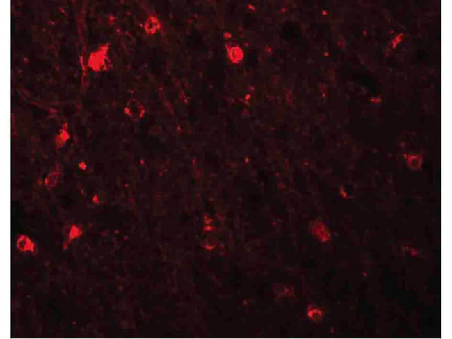 SIPA1L1 Antibody in Immunocytochemistry (ICC/IF)
