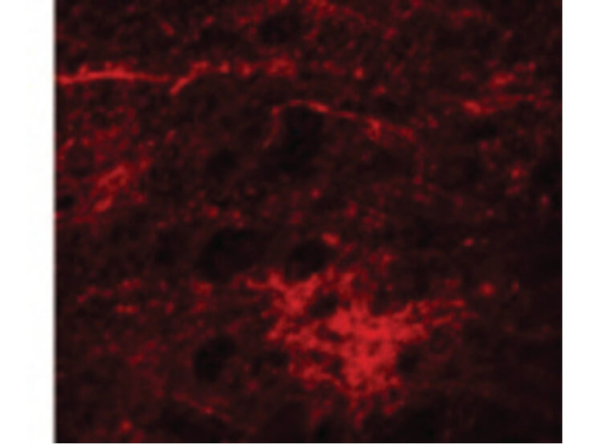 SIPA1L3 Antibody in Immunocytochemistry (ICC/IF)