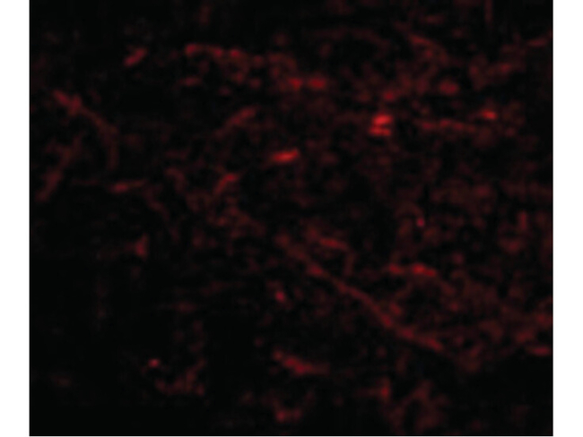 SIRT2 Antibody in Immunocytochemistry (ICC/IF)