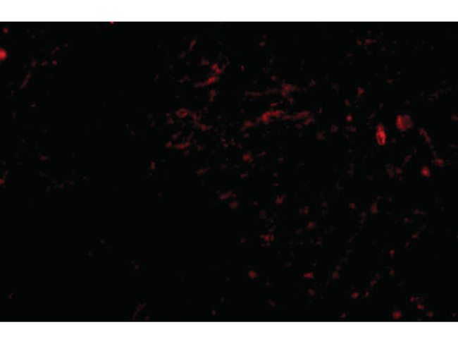 SIRT2 Antibody in Immunocytochemistry (ICC/IF)