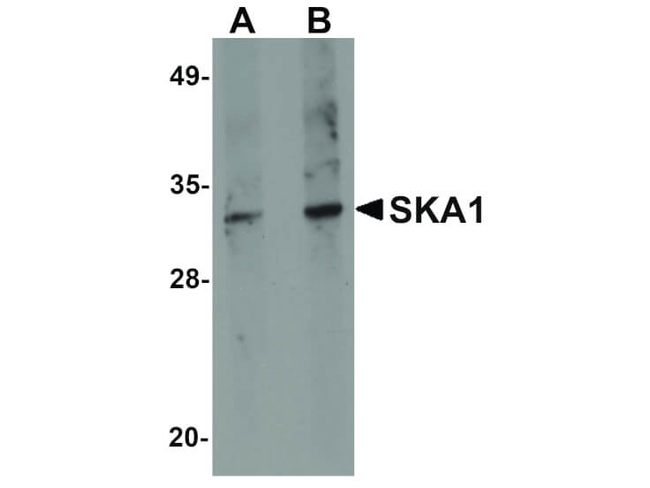 SKA1 Antibody in Western Blot (WB)