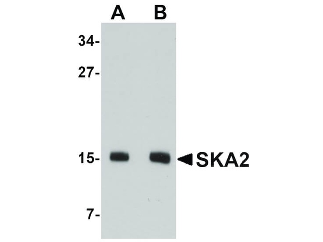 SKA2 Antibody in Western Blot (WB)