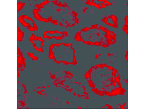 SKI Antibody in Immunocytochemistry (ICC/IF)