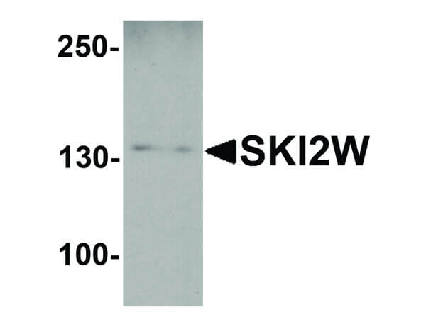 SKI2W Antibody in Western Blot (WB)