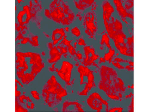SkiP Antibody in Immunocytochemistry (ICC/IF)