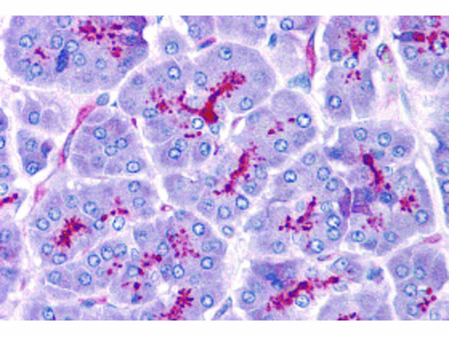 SLAIN1 Antibody in Immunohistochemistry (Paraffin) (IHC (P))