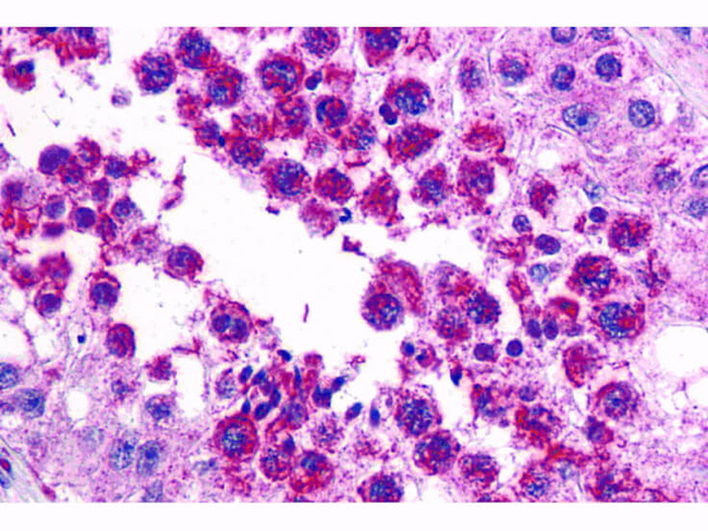 SLAIN2 Antibody in Immunohistochemistry (Paraffin) (IHC (P))