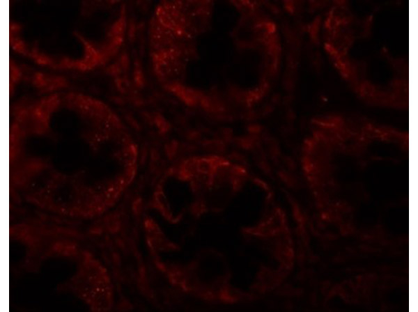 SLAMF1 Antibody in Immunocytochemistry (ICC/IF)