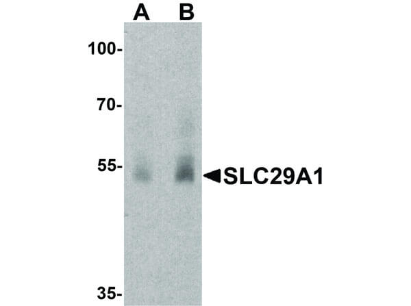 SLC29A1 Antibody in Western Blot (WB)