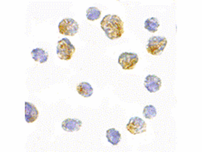 Slc35D1 Antibody in Immunocytochemistry (ICC/IF)
