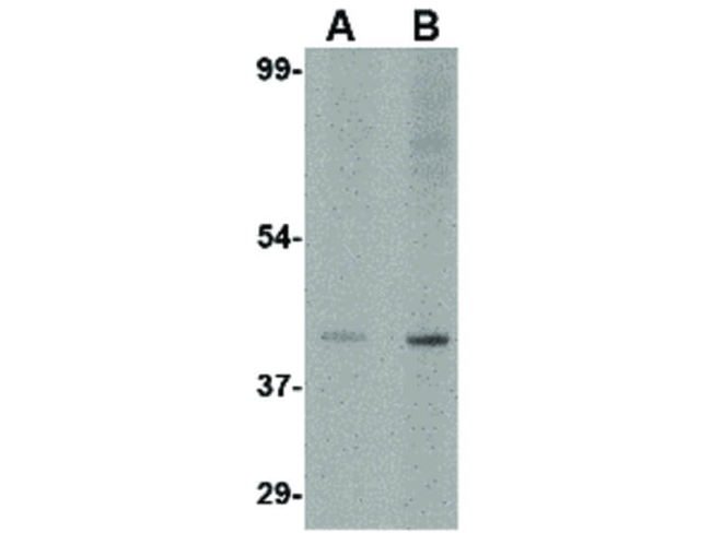 Slc35D1 Antibody in Western Blot (WB)