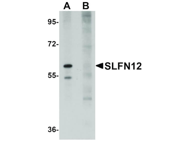 SLFN12 Antibody in Western Blot (WB)