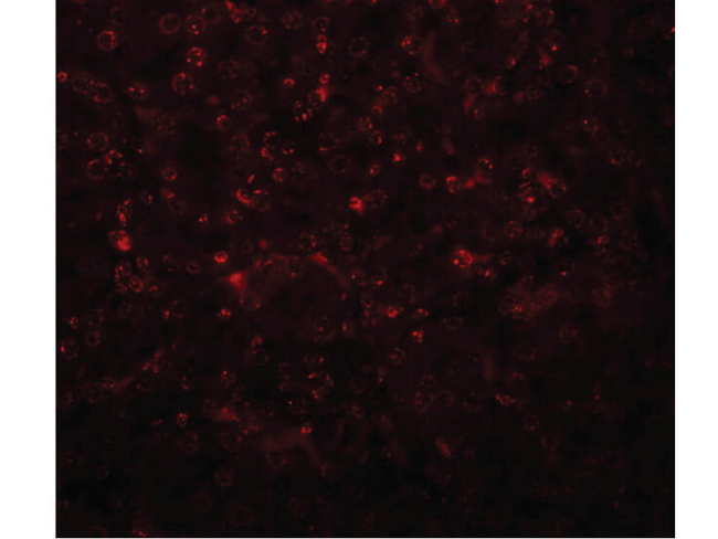 SLFN14 Antibody in Immunocytochemistry (ICC/IF)