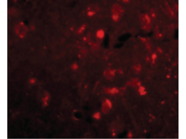 Slitrk2 Antibody in Immunocytochemistry (ICC/IF)