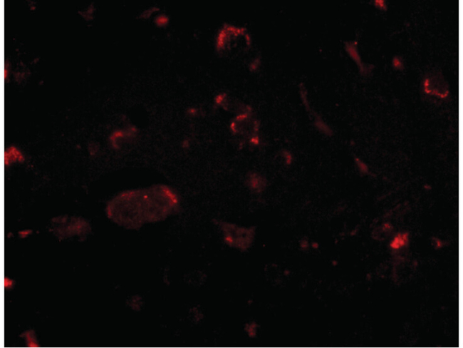 Slitrk2 Antibody in Immunocytochemistry (ICC/IF)