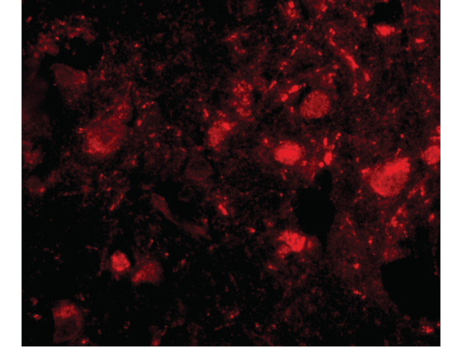 Slitrk3 Antibody in Immunocytochemistry (ICC/IF)
