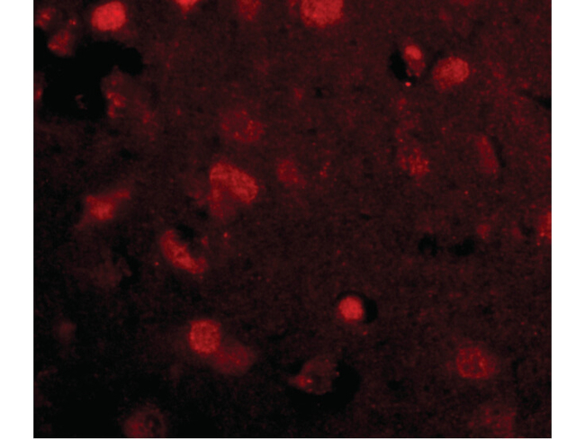Slitrk4 Antibody in Immunocytochemistry (ICC/IF)