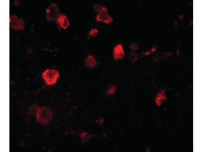 Slitrk4 Antibody in Immunocytochemistry (ICC/IF)