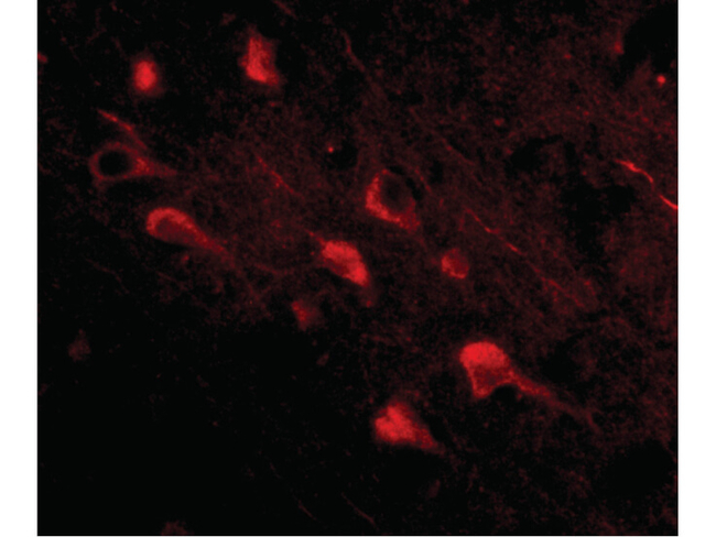 Slitrk5 Antibody in Immunocytochemistry (ICC/IF)