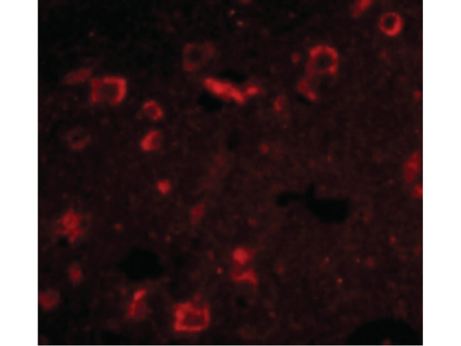 Slitrk6 Antibody in Immunocytochemistry (ICC/IF)
