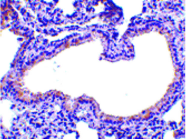 SLPI Antibody in Immunohistochemistry (Paraffin) (IHC (P))