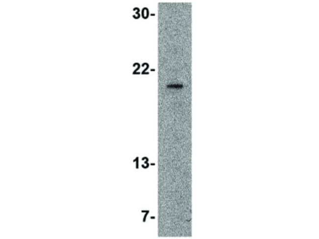 SLPI Antibody in Western Blot (WB)