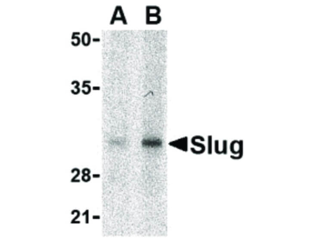Slug Antibody in Western Blot (WB)