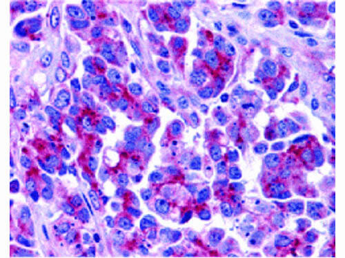 Smac Antibody in Immunohistochemistry (Paraffin) (IHC (P))