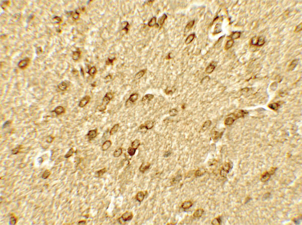 SMARCA4 Antibody in Immunocytochemistry (ICC/IF)