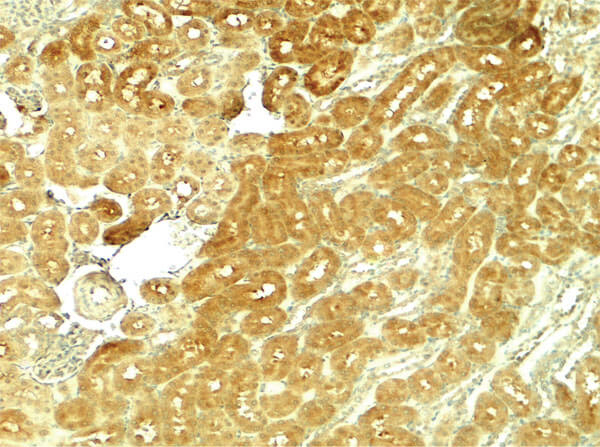 SMURF1 Antibody in Immunohistochemistry (Paraffin) (IHC (P))
