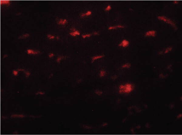 SMURF2 Antibody in Immunocytochemistry (ICC/IF)