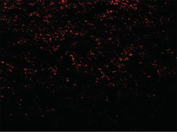 SNCA Antibody in Immunocytochemistry (ICC/IF)