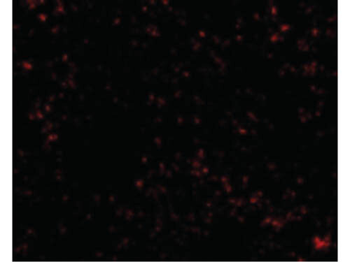 SnoN Antibody in Immunocytochemistry (ICC/IF)
