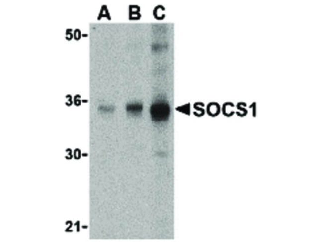 SOCS1 Antibody in Western Blot (WB)