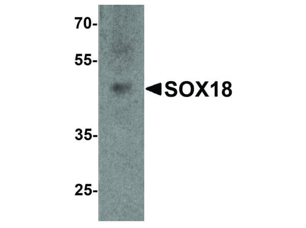 SOX18 Antibody in Western Blot (WB)