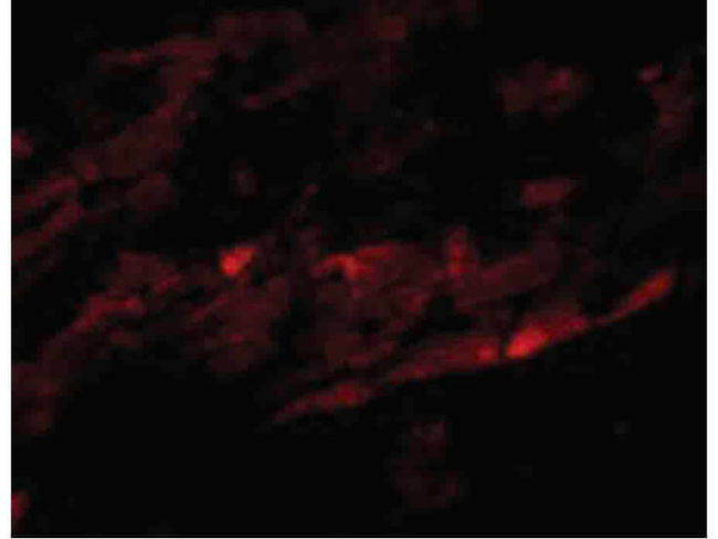 SPG15 Antibody in Immunocytochemistry (ICC/IF)