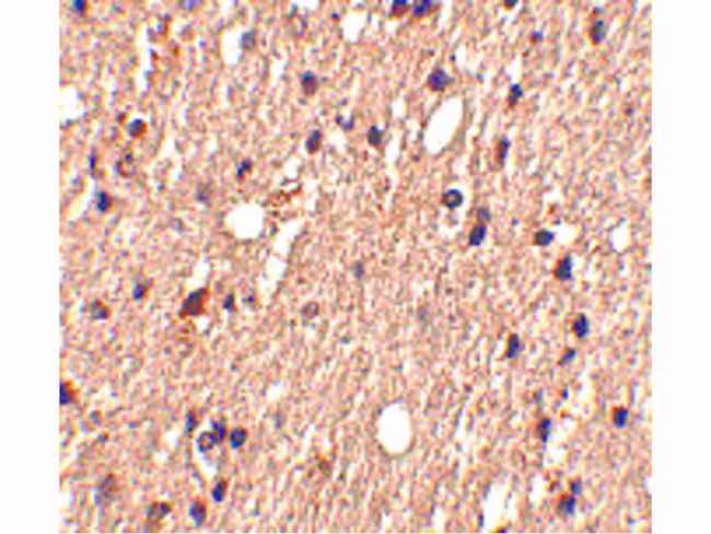Spred1 Antibody in Immunohistochemistry (Paraffin) (IHC (P))